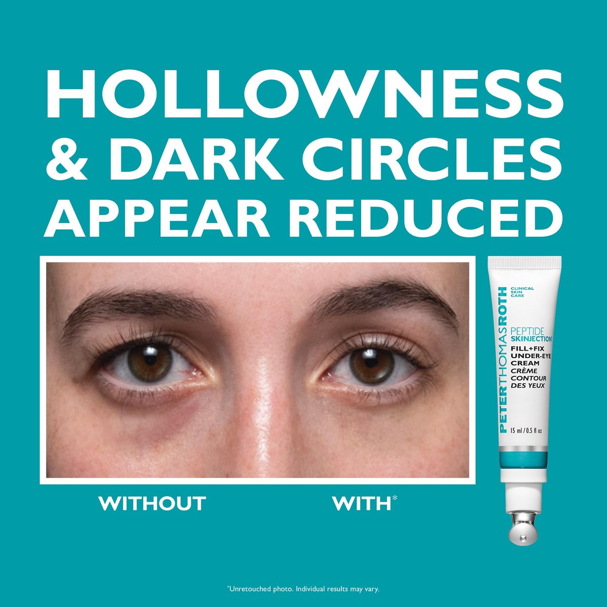 Peter Thomas Roth Full-Size Peptide Skinjection™ Solutions 2-Piece Face & Eye Kit – Anti-Aging Peptide Skincare Set with Under-Eye Cream and Moisturizer Avelisse