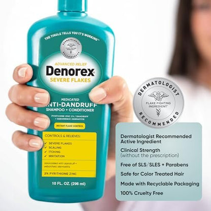 Denorex Advanced Relief Severe Flakes Anti-Dandruff 2-in-1 Shampoo & Conditioner – 2% Pyrithione Zinc for Severe Dandruff & Scalp Relief, 10 fl oz Avelisse