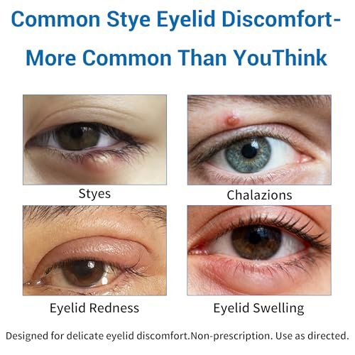 Stye Eye Treatment Serum - Stye Relief & Chalazion Drops for Swollen Eyelids, Blepharitis Care, Redness Relief, 0.5 Fl Oz Avelisse