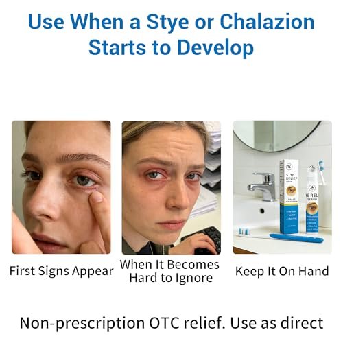 Stye Eye Treatment Serum - Stye Relief & Chalazion Drops for Swollen Eyelids, Blepharitis Care, Redness Relief, 0.5 Fl Oz Avelisse