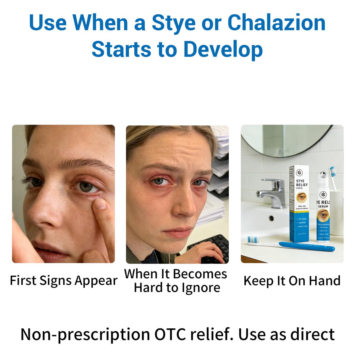 Stye Eye Treatment Serum - Stye Relief & Chalazion Drops for Swollen Eyelids, Blepharitis Care, Redness Relief, 0.5 Fl Oz Avelisse