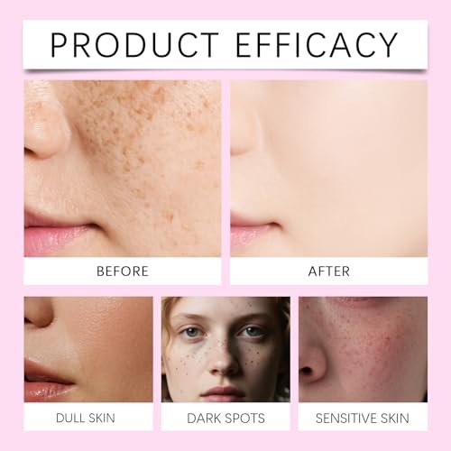 Xungess Arbutin 7% + Tranexamic Acid 4% Dark Spot Cream for Face, Brightening Moisturizer with Niacinamide, Glutathione, Gentle Skincare for Uneven Tone and Dullness, 2 Pack (3.52 fl oz) Avelisse