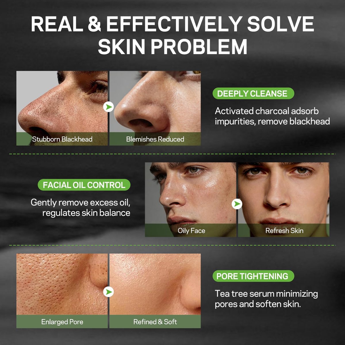 AMOADO Blackhead Remover Peel Off Face Mask & Tea Tree Oil Serum Duo - Deep Cleansing Charcoal Mask for Pore Tightening - görsel 7