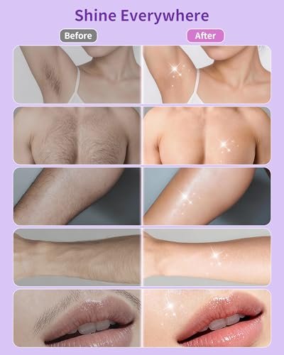KOCCQUE Wax Strips Waxing Kit for Women – 60 Strips + 6 Wipes – Legs, Arms, Face, Underarms, Bikini & Facial Hair Removal – Dermatologically Tested, 8-Week Smooth, Hypoallergenic for All Skin Types Avelisse