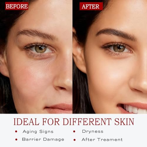 Lollsea PDRN Serum - 99% Pure Salmon DNA Anti-Aging Face Serum with Ceramide NP, Firming & Hydrating 1.69 fl oz Avelisse
