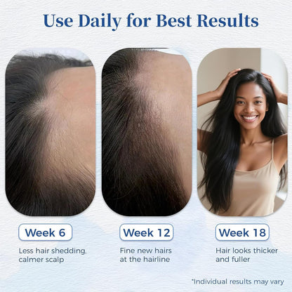 Aparthy Advanced Hair Growth Roll-On Serum - with Saw Palmetto, Rosemary & Pea Extract, Supports Thicker, Fuller Hair Appearance, Clean, Non-Greasy Hair Loss Support for Men & Women, 25ml (Pack of 2) Avelisse