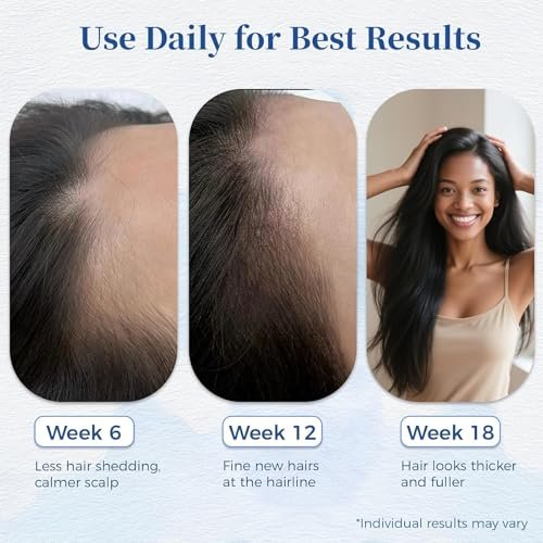 Aparthy Advanced Hair Growth Roll-On Serum - with Saw Palmetto, Rosemary & Pea Extract, Supports Thicker, Fuller Hair Appearance, Clean, Non-Greasy Hair Loss Support for Men & Women, 25ml (Pack of 2) Avelisse