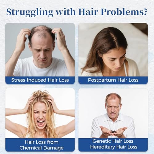 Aparthy Advanced Hair Growth Roll-On Serum - with Saw Palmetto, Rosemary & Pea Extract, Supports Thicker, Fuller Hair Appearance, Clean, Non-Greasy Hair Loss Support for Men & Women, 25ml (Pack of 2) Avelisse