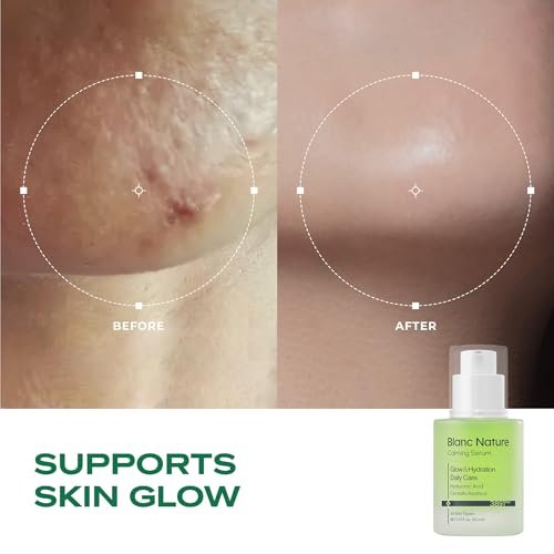 Blanc Nature Calming Serum – Soothing & Hydrating Serum with Hyaluronic Acid, Centella Asiatica & Panthenol for Glass Skin, All Skin Types, 1.01 fl oz (30 ml) Avelisse