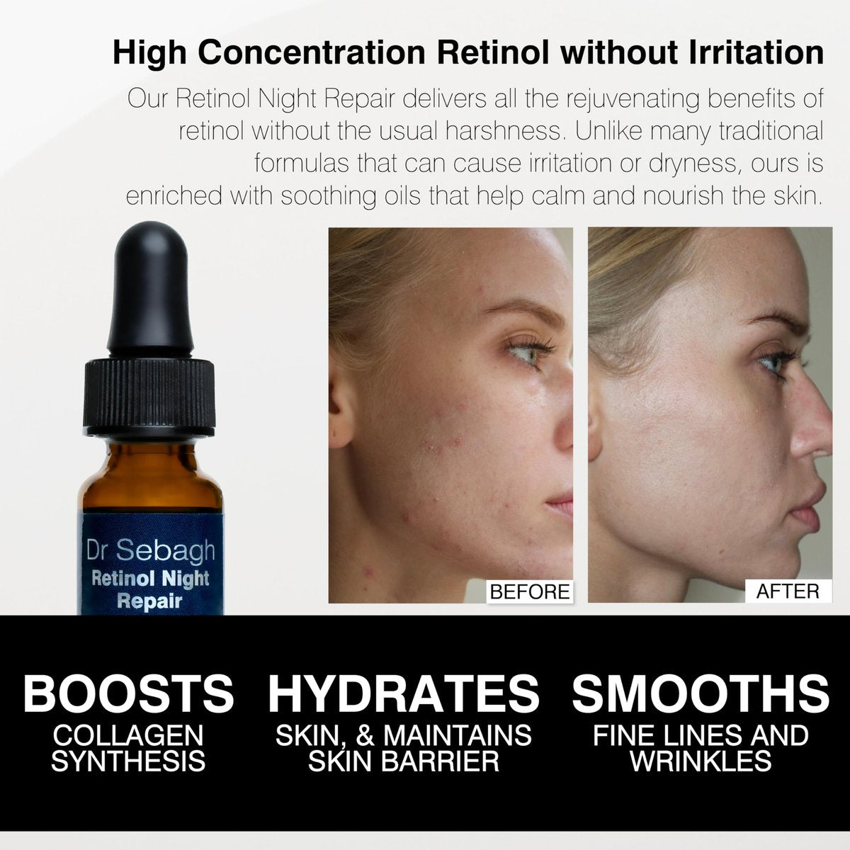 Dr Sebagh Retinol Night Repair - High-Strength Retinol Serum for Face with Vitamin E, Rosehip Oil & Squalane Avelisse