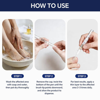 Toenail Fungus Pen - 25% Undecylenic Acid - Nail Repair for Damaged, Ingrown & Discolored Nails - 4-Pack Twist Pen