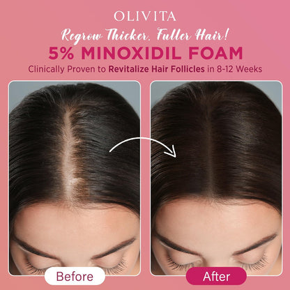 5% Minoxidil Foam for Women Hair Growth | Extra Strength Hair Regrowth Treatment – Revitalize Hair Follicles & Regrow Thicker, Fuller Hair – Hair Loss Solution (2-Pack) Avelisse