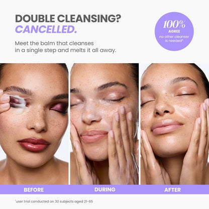 Wonderskin Melt It All Balm to Milk Makeup Remover - Gentle Hydrating Face Cleanser with Centella and Chamomile