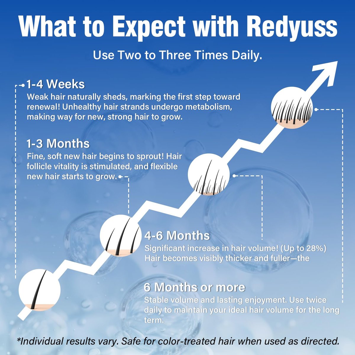 Redyuss 5% Minoxidil Hair Growth Spray Serum with Biotin for Men and Women – 3 Bottles of 2oz, Thicker, Fuller, Healthier Hair Avelisse
