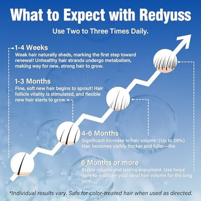 Redyuss 5% Minoxidil Hair Growth Spray Serum with Biotin for Men and Women – 3 Bottles of 2oz, Thicker, Fuller, Healthier Hair Avelisse