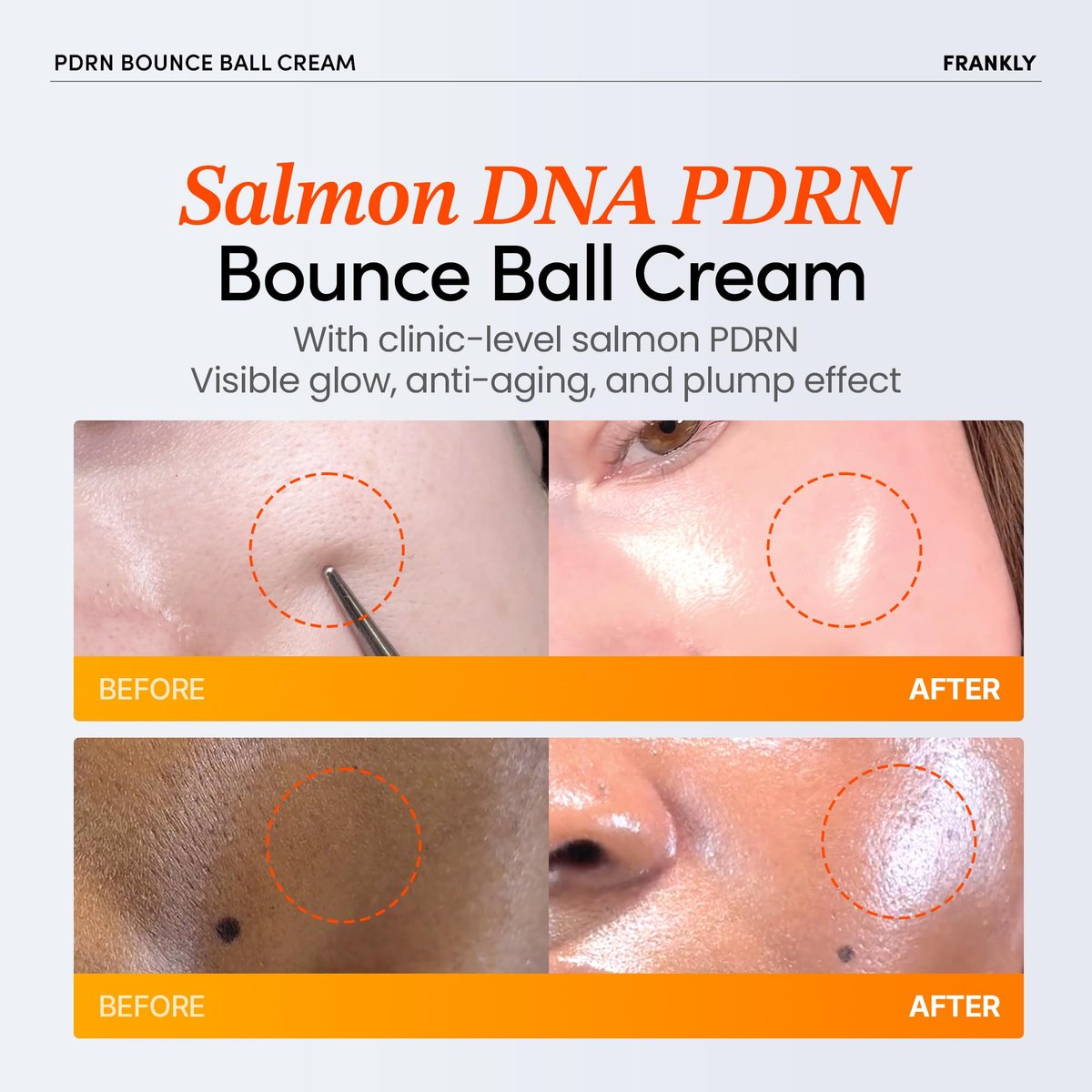 FRANKLY Salmon PDRN Bounce Ball Cream – 99% Pure Salmon DNA Moisturizer for Skin Repair & Glow | Post Microneedling Recovery & Barrier Repair | Lightweight Gel Cream | Korean Skincare | 1.69 fl oz Avelisse