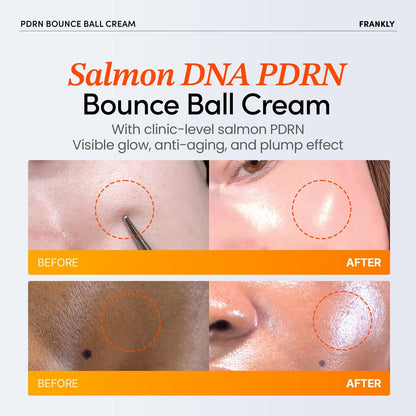FRANKLY Salmon PDRN Bounce Ball Cream – 99% Pure Salmon DNA Moisturizer for Skin Repair & Glow | Post Microneedling Recovery & Barrier Repair | Lightweight Gel Cream | Korean Skincare | 1.69 fl oz Avelisse