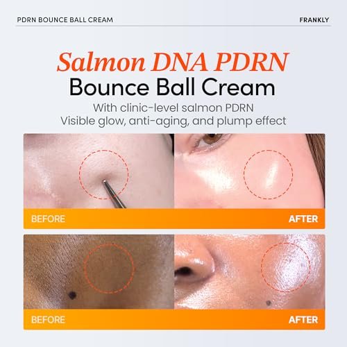 FRANKLY Salmon PDRN Bounce Ball Cream – 99% Pure Salmon DNA Moisturizer for Skin Repair & Glow | Post Microneedling Recovery & Barrier Repair | Lightweight Gel Cream | Korean Skincare | 1.69 fl oz Avelisse