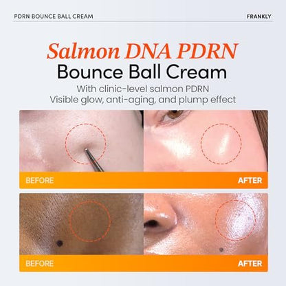 FRANKLY Salmon PDRN Bounce Ball Cream – 99% Pure Salmon DNA Moisturizer for Skin Repair & Glow | Post Microneedling Recovery & Barrier Repair | Lightweight Gel Cream | Korean Skincare | 1.69 fl oz Avelisse
