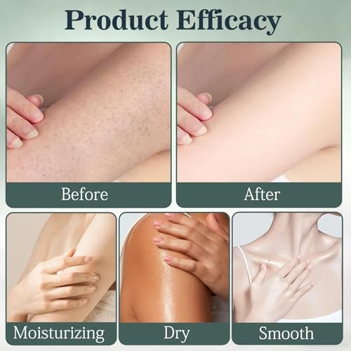 VOYOCUGE Intertrigo Cream, Skin Fold Care & Chafing Support Cream – Fast-Drying, Non-Greasy for Friction-Prone Areas (2-Pack, 2 oz Each) Avelisse