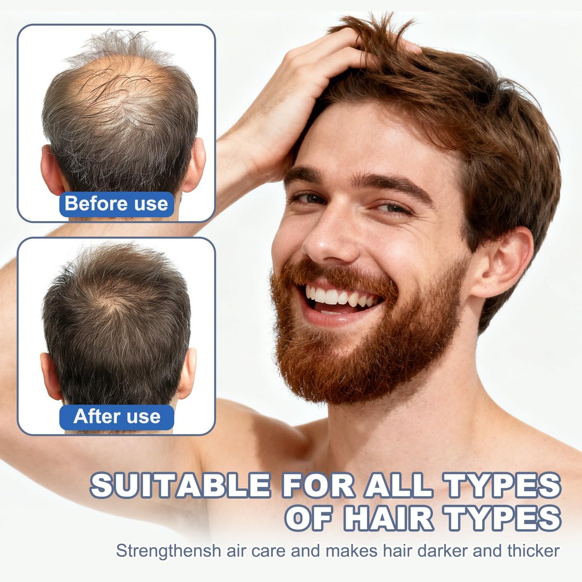 Root Activator Shampoo for Men & Women - Strengthening & Smoothing System for Thinning and Gray Hair - Adds Volume & Nourishes Strands (6.8 Fl Oz) - görsel 9