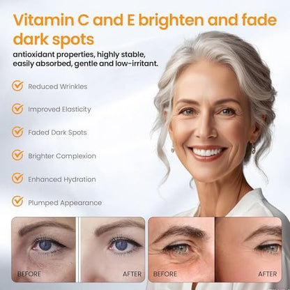 Vitamin C Serum with Hyaluronic Acid, Vitamin E, Tri-Peptide & B5 - Dark Spot Remover, Anti-Aging, Firming, Brightening & Lifting for Mature Skin, 1 fl oz Avelisse