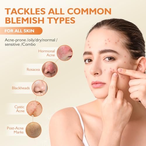 elesysy Organics Acne Killer Day Balm 2.0 – Natural Botanical Acne Treatment for Face, Body & Back | Reduces Pimples, Blackheads & Redness | Balancing, Hydrating & Non-Comedogenic Avelisse