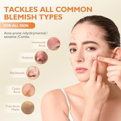 elesysy Organics Acne Killer Day Balm 2.0 – Natural Botanical Acne Treatment for Face, Body & Back | Reduces Pimples, Blackheads & Redness | Balancing, Hydrating & Non-Comedogenic Avelisse