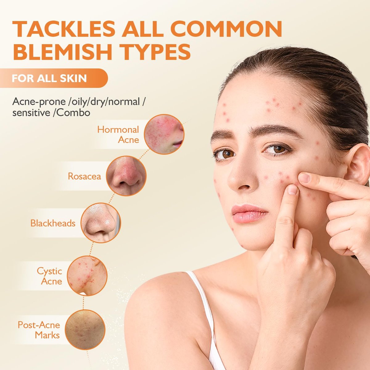 elesysy Organics Acne Killer Day Balm 2.0 – Natural Botanical Acne Treatment for Face, Body & Back | Reduces Pimples, Blackheads & Redness | Balancing, Hydrating & Non-Comedogenic Avelisse