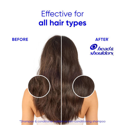 Head & Shoulders Smooth & Silky 2 in 1 Dandruff Shampoo and Conditioner, Frizz Control, Fresh Floral Scent, Color Safe, 28.2 oz