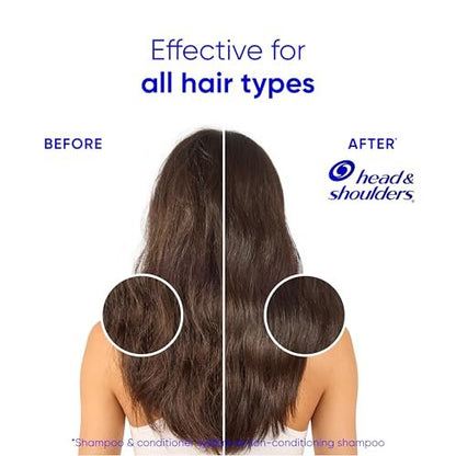 Head & Shoulders Smooth & Silky 2 in 1 Dandruff Shampoo and Conditioner, Frizz Control, Fresh Floral Scent, Color Safe, 28.2 oz