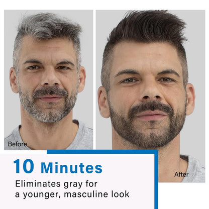 Fvquhvo Men's Beard Dye & Hair Dye Shampoo - Semi-Permanent Black Color for Instant Gray Coverage, Natural Formula, Works in 10 Minutes (500ml) Avelisse