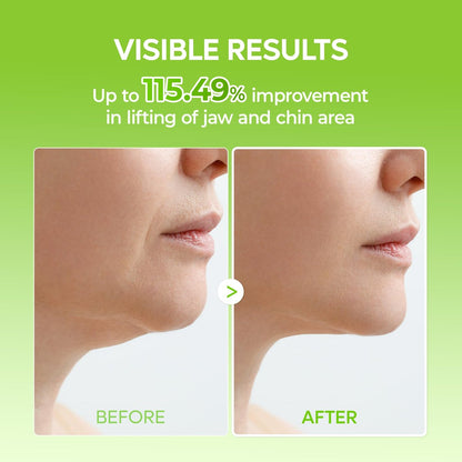 Dr.Melaxin CACTOX V-Lifting Mewing Band – Cactox + Caffeine + Collagen Double Chin Lifting Band for Sagging Jawline & Facial Puffiness | 115.49% Jaw & Chin Lifting Improvement | Korean V-Line Lifting (Green, 4 Pack) Avelisse