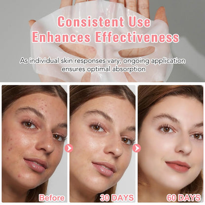 BXRUIAGN Collagen Face Mask & Smile Line Patches – Korean Skincare Sheet Mask for Wrinkle Smoothing & Radiance (Pink, 4 Count)