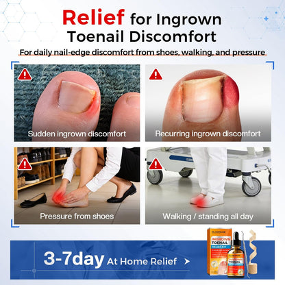 Glamonade Ingrown Toenail Relief Kit: Professional At-Home Ingrown Toenail Softening Drops with Lifter & Self-Adhesive Bandage for Mild Curved Toenails, 30ml Avelisse