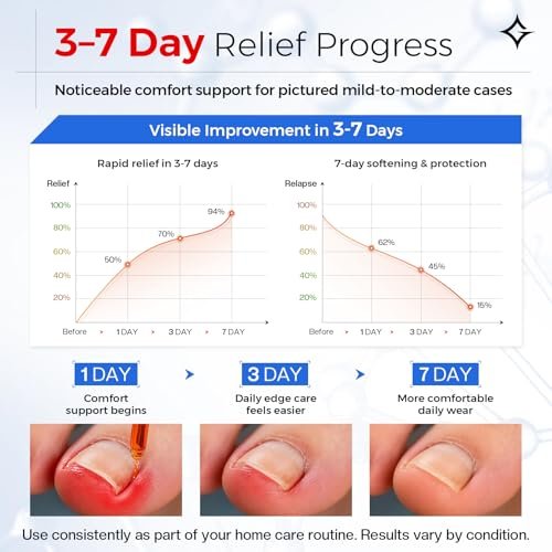 Glamonade Ingrown Toenail Relief Kit: Professional At-Home Ingrown Toenail Softening Drops with Lifter & Self-Adhesive Bandage for Mild Curved Toenails, 30ml Avelisse