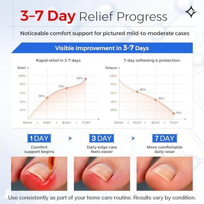 Glamonade Ingrown Toenail Relief Kit: Professional At-Home Ingrown Toenail Softening Drops with Lifter & Self-Adhesive Bandage for Mild Curved Toenails, 30ml Avelisse