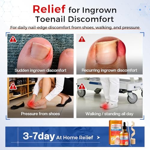 Glamonade Ingrown Toenail Relief Kit: Professional At-Home Ingrown Toenail Softening Drops with Lifter & Self-Adhesive Bandage for Mild Curved Toenails, 30ml Avelisse