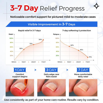 Glamonade Ingrown Toenail Relief Kit: Professional At-Home Ingrown Toenail Softening Drops with Lifter & Self-Adhesive Bandage for Mild Curved Toenails, 30ml Avelisse