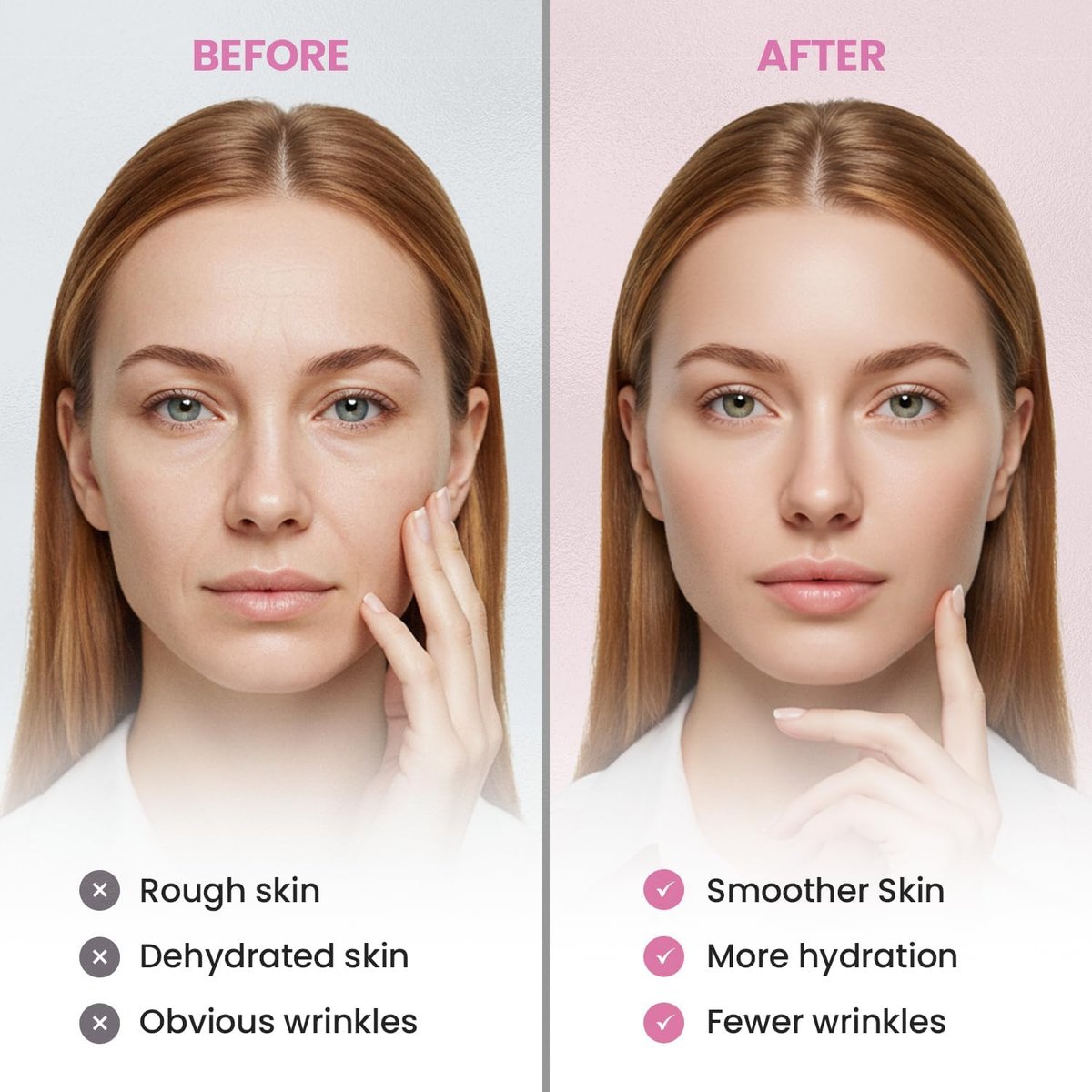 Adellina Anti Wrinkle Patches Overnight - Smile Line Patches for Forehead, Under Eyes - 144 Count Avelisse