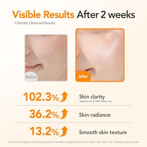 BALOOM 10% Niacinamide Dark Spot Remover For Face – Korean Skin Care for Uneven Tone, Discoloration & Pore Minimizing – Brightening Glutathione Face Serum for Hydration & Glass Skin – 1.69 fl oz Avelisse