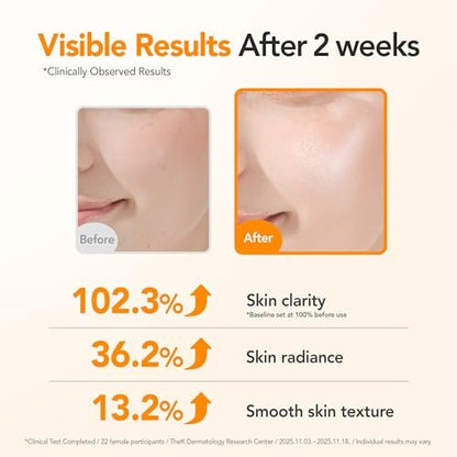 BALOOM 10% Niacinamide Dark Spot Remover For Face – Korean Skin Care for Uneven Tone, Discoloration & Pore Minimizing – Brightening Glutathione Face Serum for Hydration & Glass Skin – 1.69 fl oz Avelisse