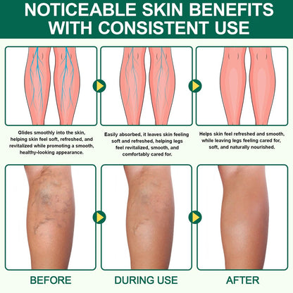 2 Box Miracle Balm - Natural Ingredients for Relaxed, Comfortable Legs, Arms & Back (1 oz Each) Avelisse