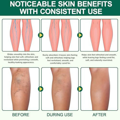 2 Box Miracle Balm - Natural Ingredients for Relaxed, Comfortable Legs, Arms & Back (1 oz Each) Avelisse