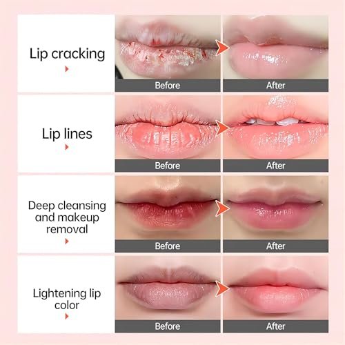 Natural Lip Lightening Balm with Hyaluronic Acid – Exfoliates, Fades Discoloration & Moisturizes for Smokers, Men & Women (2 Count) Avelisse