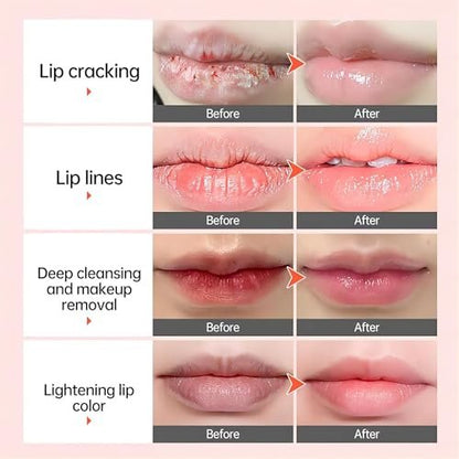 Natural Lip Lightening Balm with Hyaluronic Acid – Exfoliates, Fades Discoloration & Moisturizes for Smokers, Men & Women (2 Count) Avelisse