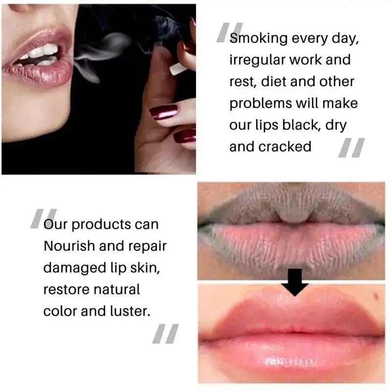 Natural Lip Lightening Balm with Hyaluronic Acid – Exfoliates, Fades Discoloration & Moisturizes for Smokers, Men & Women (2 Count) Avelisse