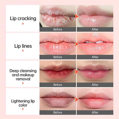 Natural Lip Lightening Balm with Hyaluronic Acid – Exfoliates, Fades Discoloration & Moisturizes for Smokers, Men & Women (2 Count) Avelisse