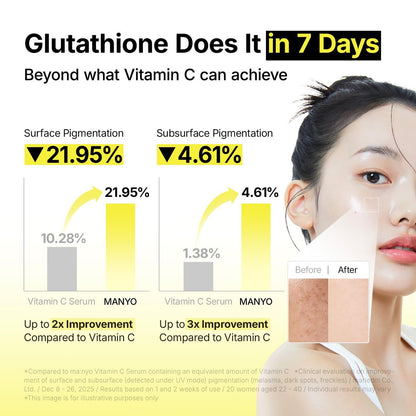 MANYO Glutathione 7 Dark Spot Serum - Niacinamide Serum for Uneven Skin Tone, Dark Spot Remover & Radiance Booster, Korean Skincare, 1.01 fl.oz (30ml)
