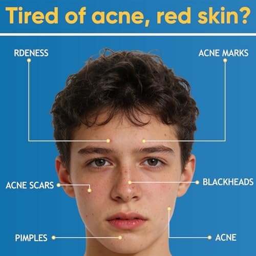 Acne & Redness Killer 2-Pack – Organic Acne Balm for All Skin Types Avelisse